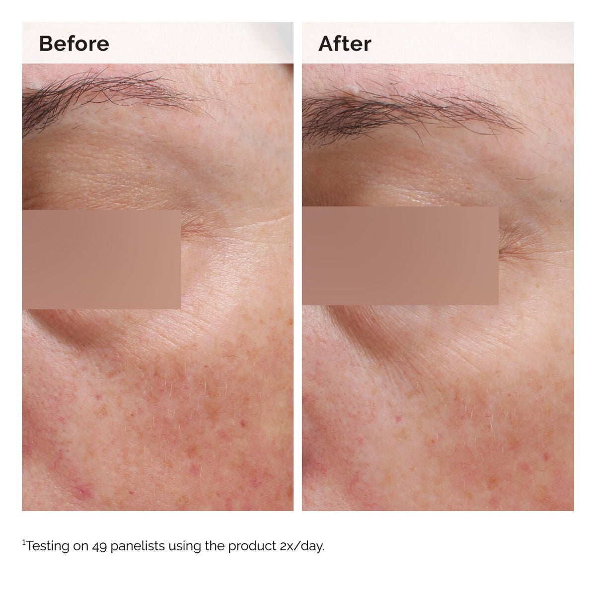 niacinamide-5-face-and-body-emulsion-j8 2024-08-23-ORD-Nia-5pct-Face-Body-B-A-Elasticity-Global-02-1x1.jpg