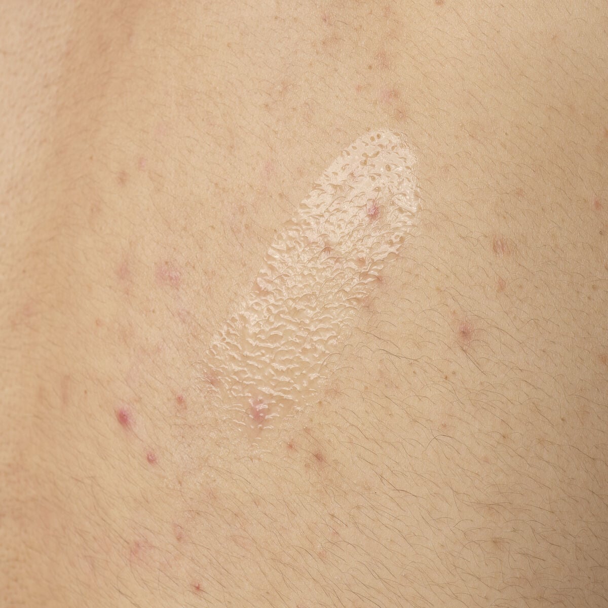 salicylic-acid-0-5-body-serum-j6 ORD-salicylic-acid-05-body-240ml-application.jpg