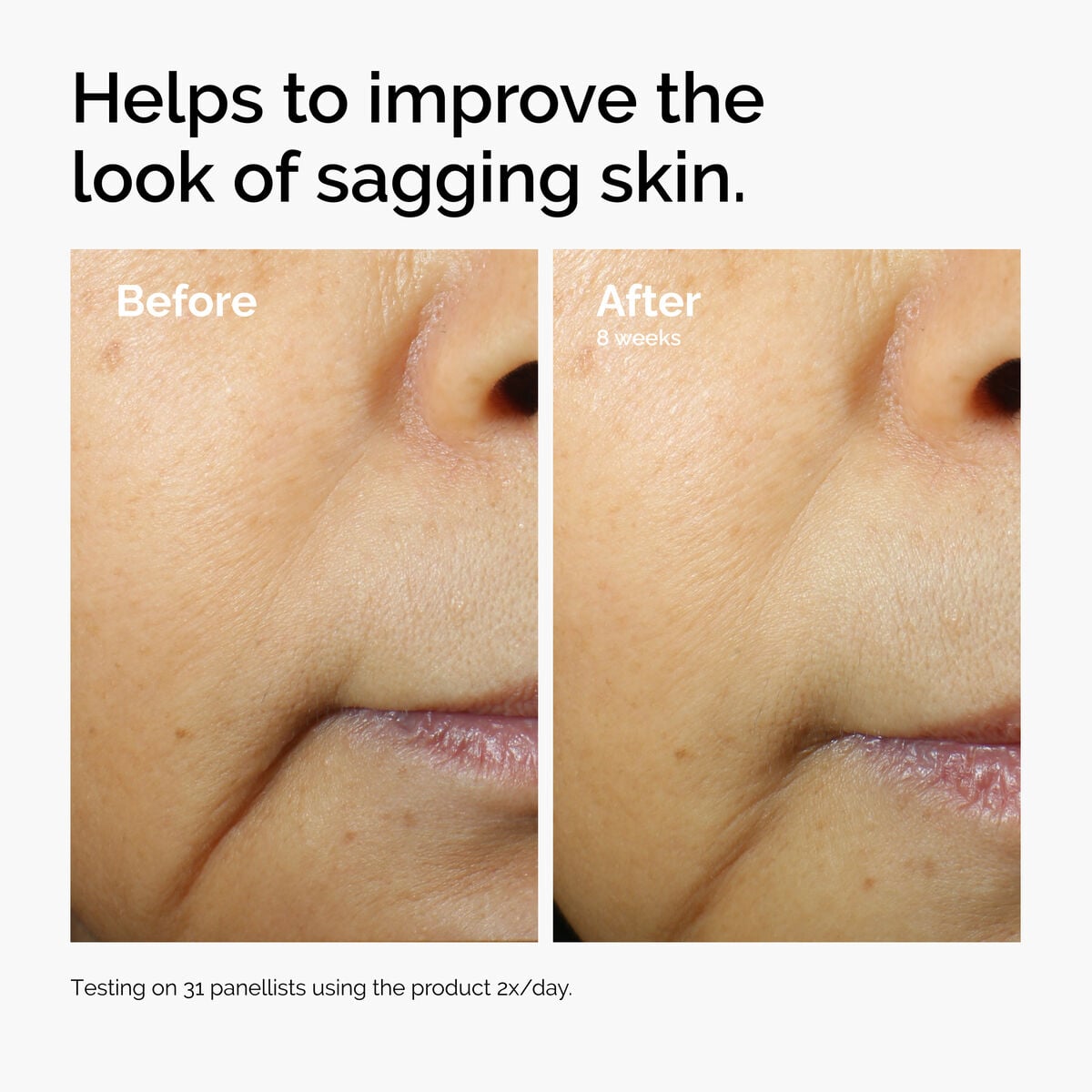caffeine-3-escin-1-face-serum-r0 ord-caffeine-3pct-escin-1pct-face-serum-before-after-sagging.jpg