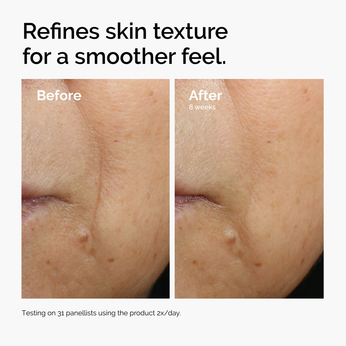 caffeine-3-escin-1-face-serum-r0 ord-caffeine-3pct-escin-1pct-face-serum-before-after-texture.jpg