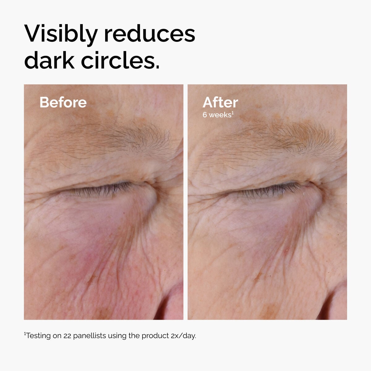 caffeine-solution-5-egcg-eye-serum-j8 ord-caffeine-solution-egcg-dark-circles-before-after.jpg
