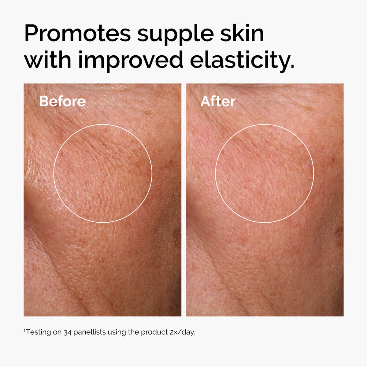 hyaluronic-acid-2-b5-with-ceramides-h6 ord-hyaluronic-acid-2pct-b5-hydrating-serum-before-after-elasticity.jpg