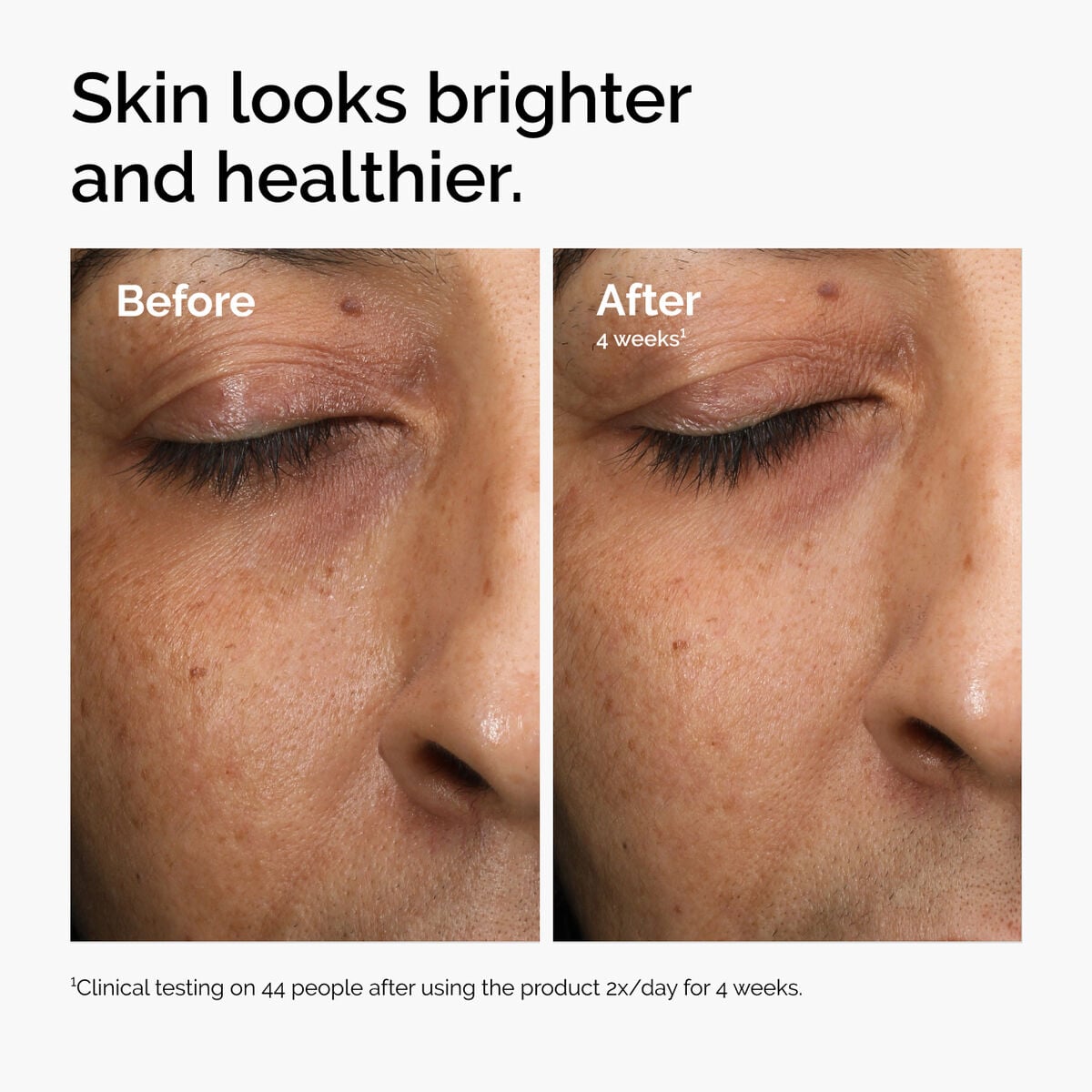 multi-antioxidant-radiance-serum-o3 ord-mars-before-after-healthy.jpg