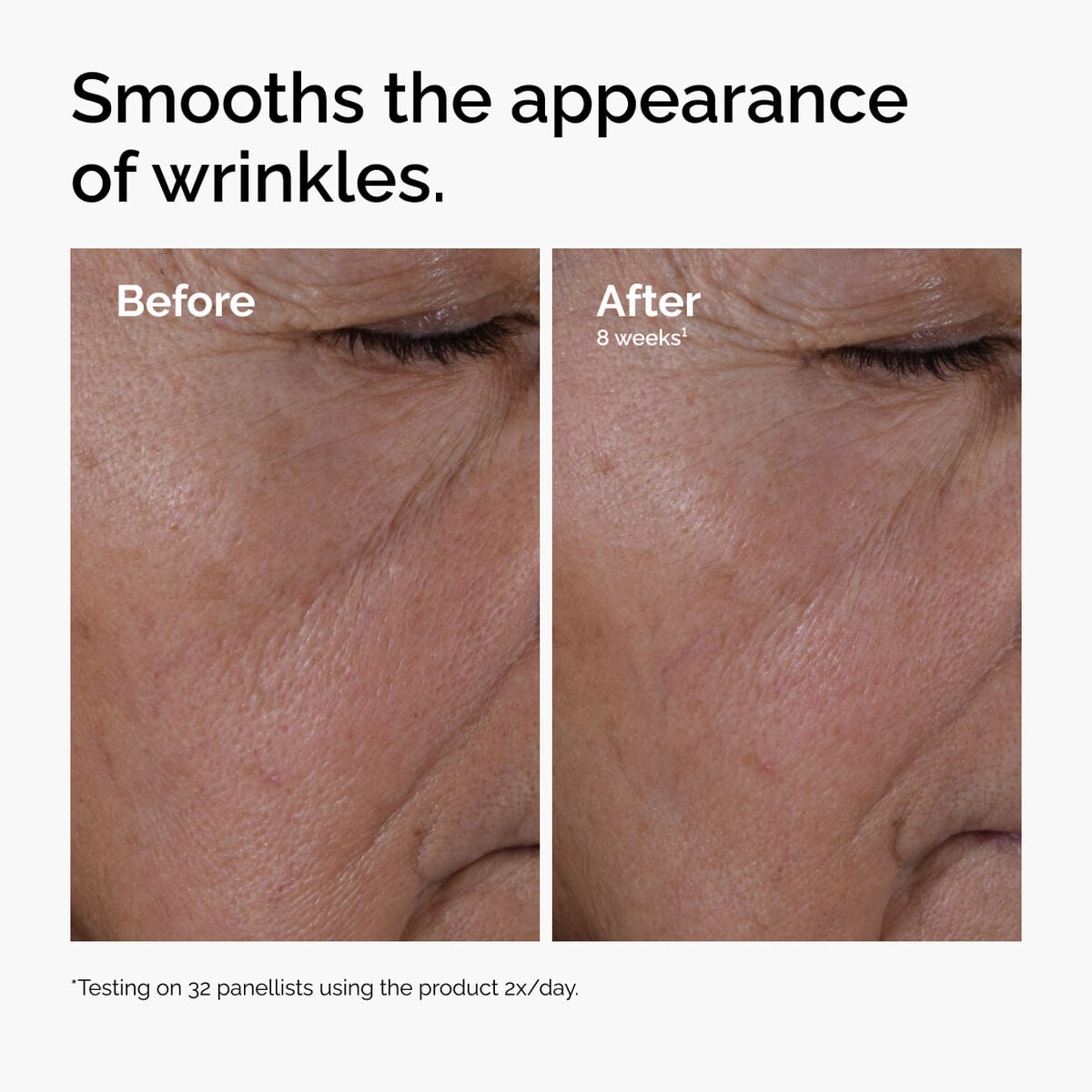 multi-peptide-ha-serum-x3 ord-multi-peptide-ha-serum-wrinkles-before-after.jpg