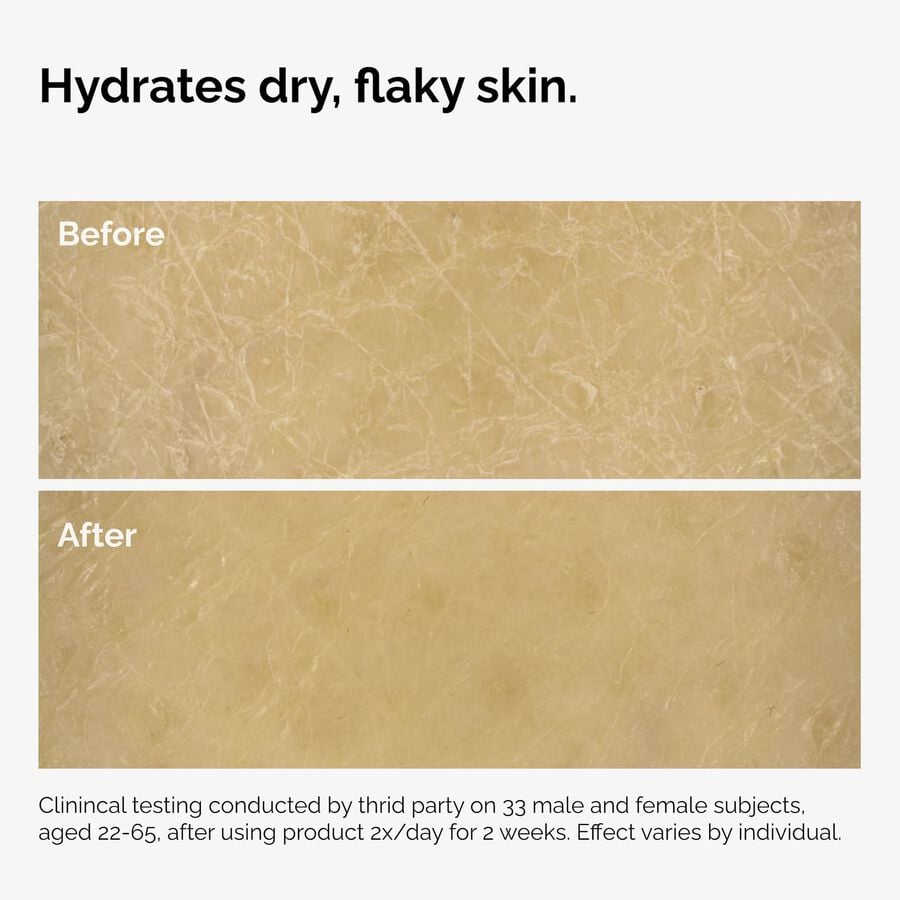 the-body-care-collection-k3 ord-natural-moisturizing-factors-inulin-body-before-after-graphic-02.jpg