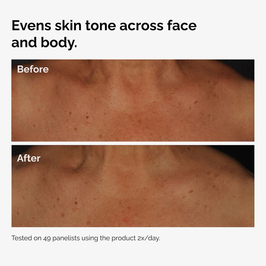 the-body-care-collection-k3 ord-niacinamide-face-body-serum-before-after-even-tone-graphic.jpg