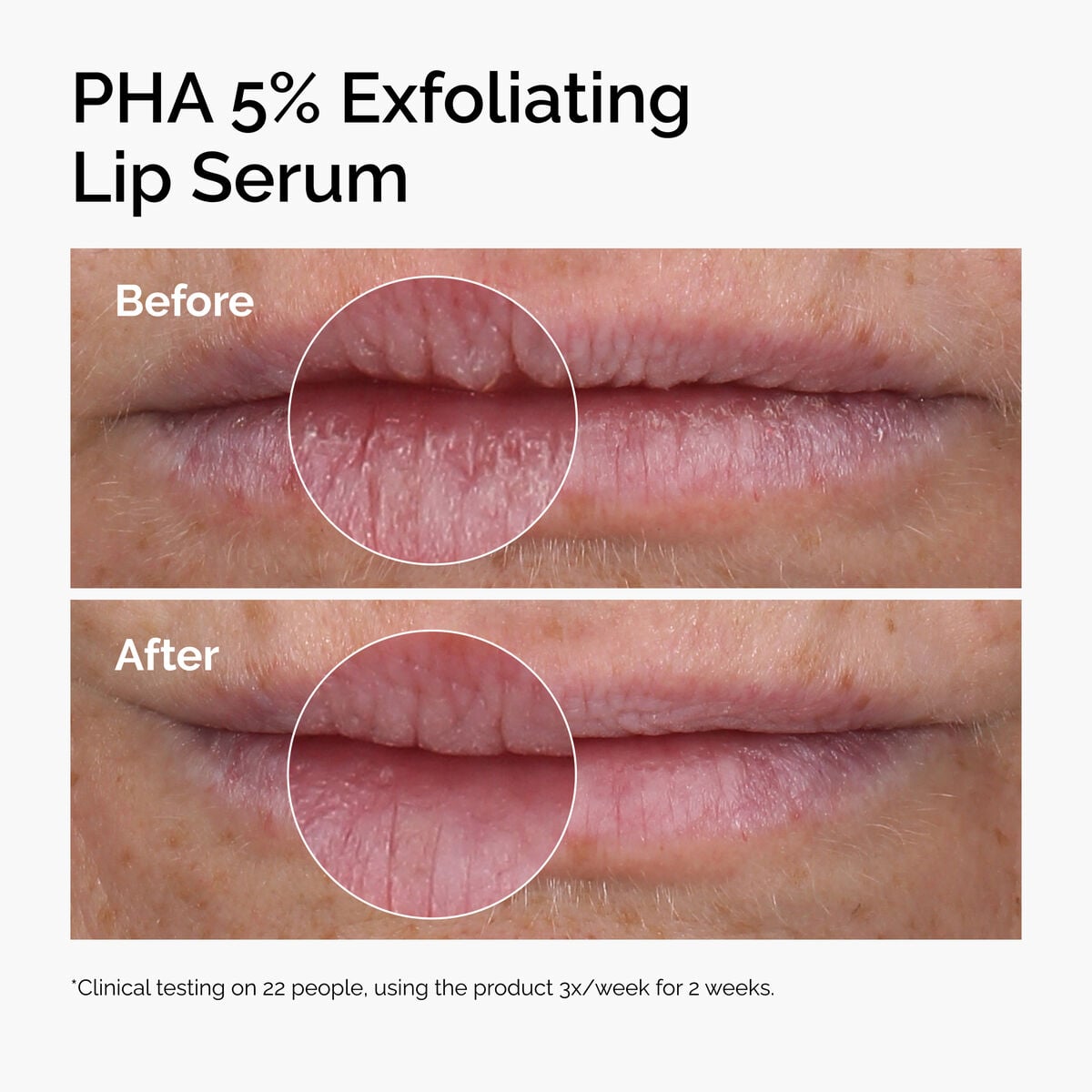 pha-5-exfoliating-lip-serum-l0 ord-pha-5pct-lip-exfoliating-serum-before-after.jpg