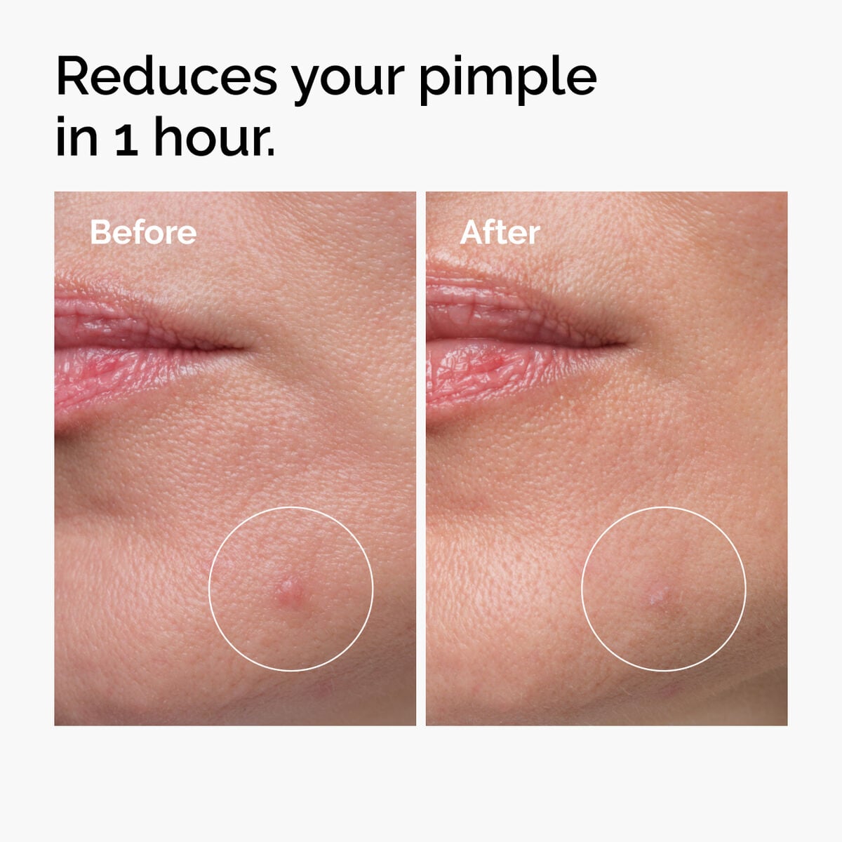 sulfur-10-powder-to-cream-concentrate-g3 ord-sulfur-10pct-powder-to-cream-concentrate-before-after-NA.jpg